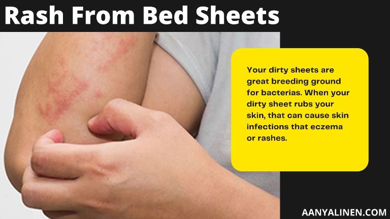 The Rash From Bed Sheets | Prevention Tips